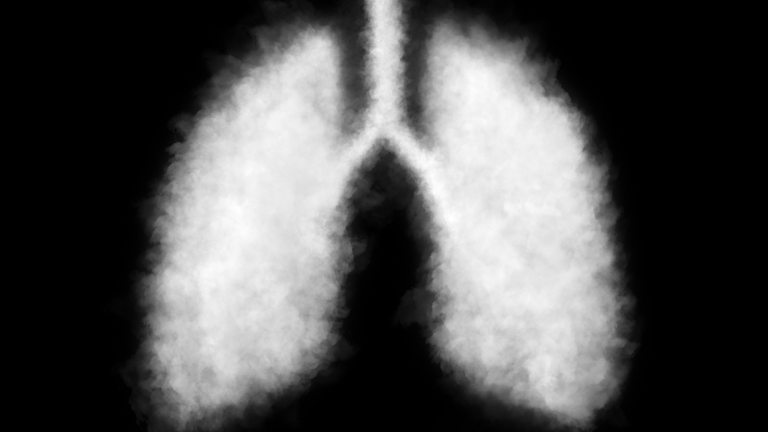 El brote de lesiones pulmonares conocido como «EVALI» no tuvo nada que ver con el vapeo de nicotina